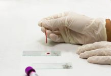 Chronic Kidney Disease and Black Americans: The Screening Test That Finally Changed chronic-kidney-disease-screening-test