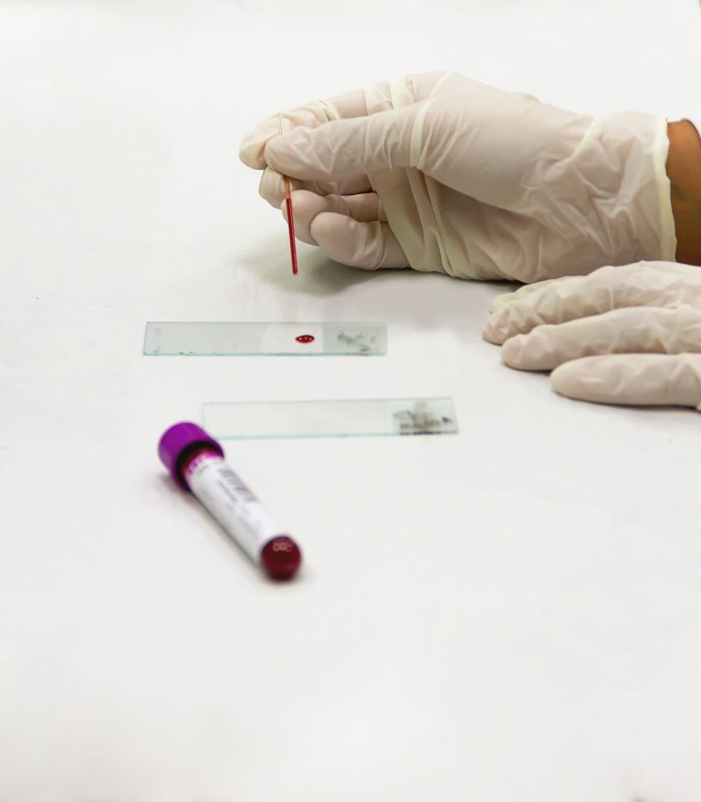 Chronic Kidney Disease and Black Americans: The Screening Test That Finally Changed